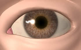 eyesperm